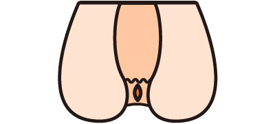 2.裂肛（れっこう・切れ痔）